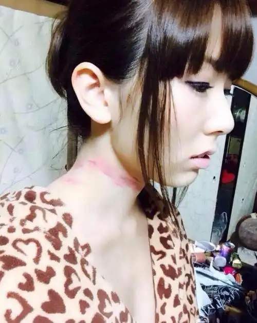 波多野结衣拍戏出现意外,脖子现明显勒痕,网友:心疼