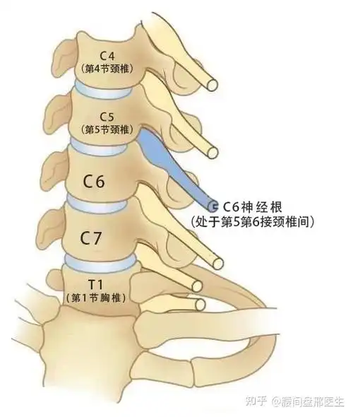 颈椎间盘侧后方突出,椎体间关节的增生,肥大等,使得其间走行的神经根