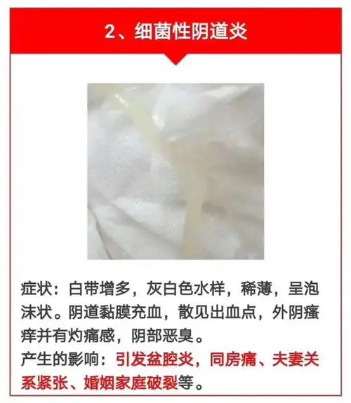 如何识别你的白带! | 妈妈网轻聊_千万女人的共同选择
