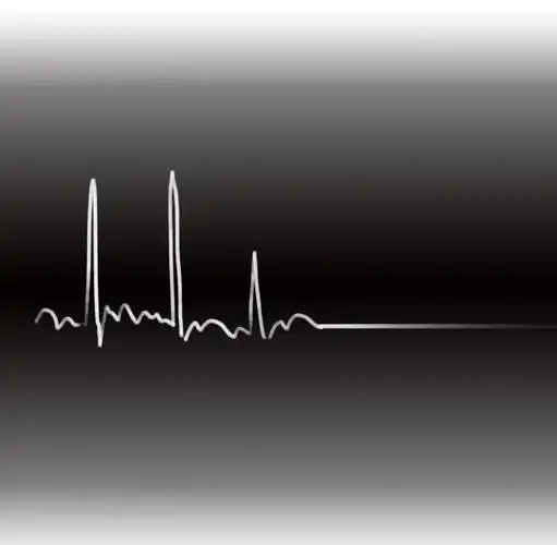 猝死发生前,身体会有什么特殊感觉|心脏骤停|冠状动脉|心血管|心电图