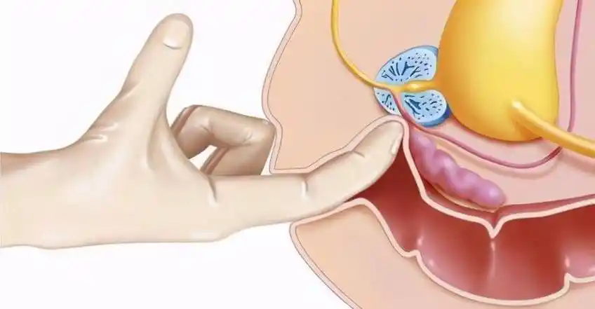 听听男科医生怎么说_睾丸_治疗_检查