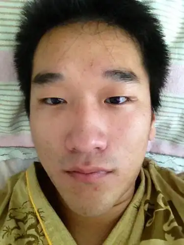 脸色发黄是为什么,感觉不正常啊