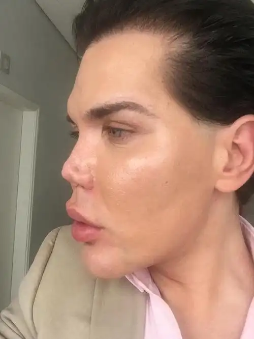 鹰钩鼻,顾名思义,就是指鼻子形状像鹰钩一样弯曲的一种外形.