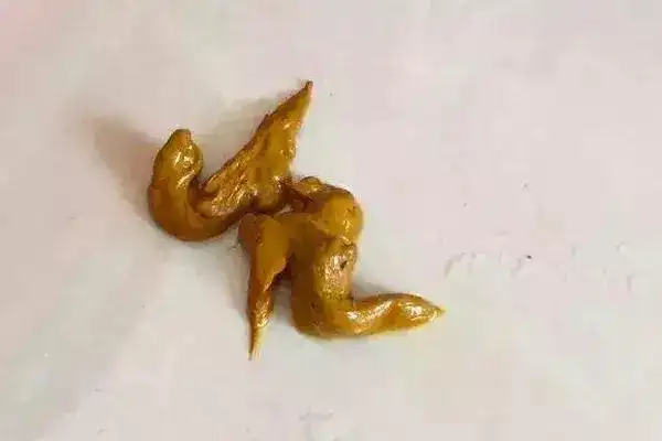 大便拉出油脂图片(大便拉出油脂怎么回事)-江湖救急网