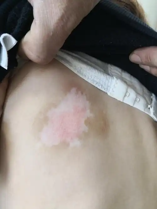 解决皮肤问题专注皮肤美容##白癜风