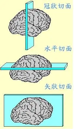一文为您介绍大小鼠脑切片模具质量好坏的区别