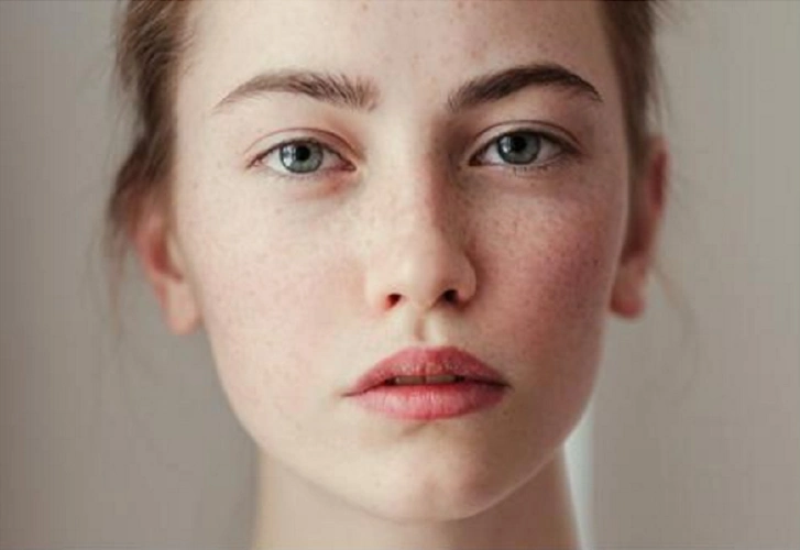 日晒斑不会自己消失做这3件事来淡化它