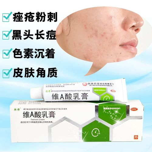 人员在医学杂志柳叶刀上发表报告说,他们比较了目前英国治疗痤疮的5