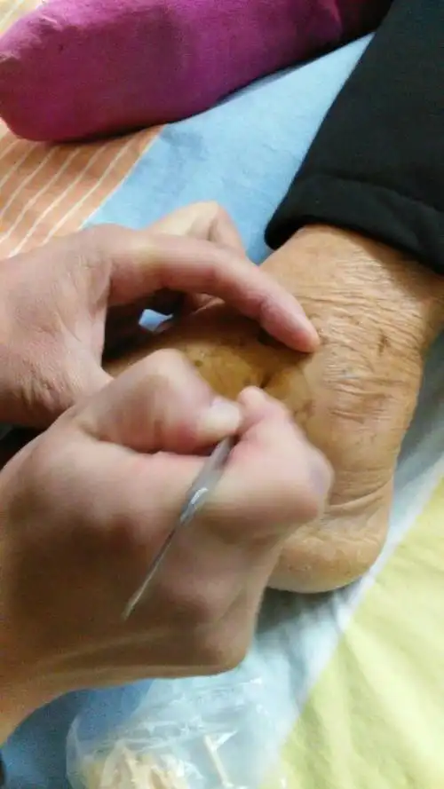 九针一一锋钩针