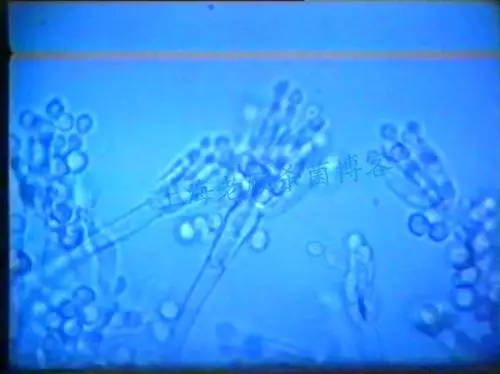 常见霉菌显微图片