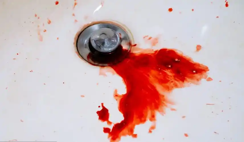 医生:流鼻血不一定是上火,小心鼻咽癌