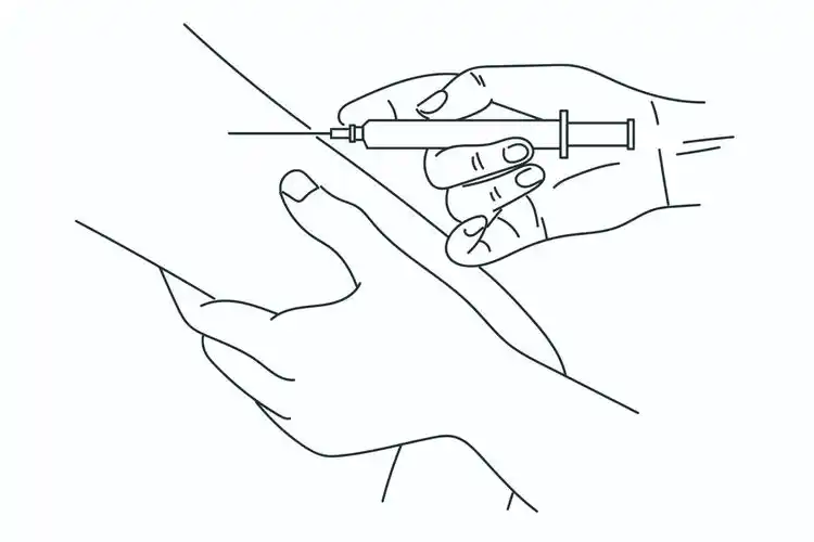 注射器持针手法示意图