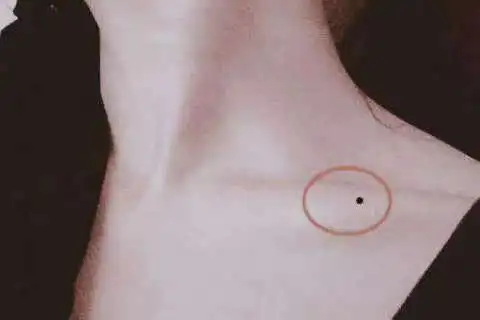 锁骨有痣的人命运如何