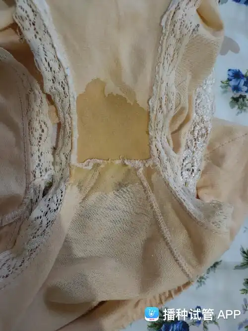 怀孕七周了,内裤上有这种分泌物正常吗?