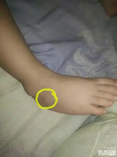 小孩脚踝骨头突出图_发型图片