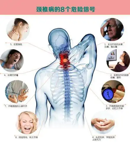 颈椎病又称颈椎综合征,是颈椎骨关节炎,增生性颈椎炎,颈神经根综合征