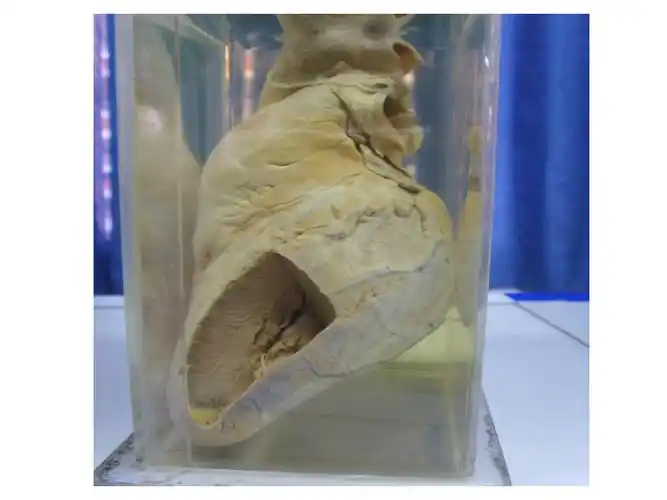 病理学实验大体标本