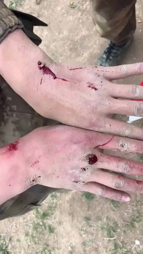 这就是军人的手,爬战术的伤,总在结疤和受伤之间反复