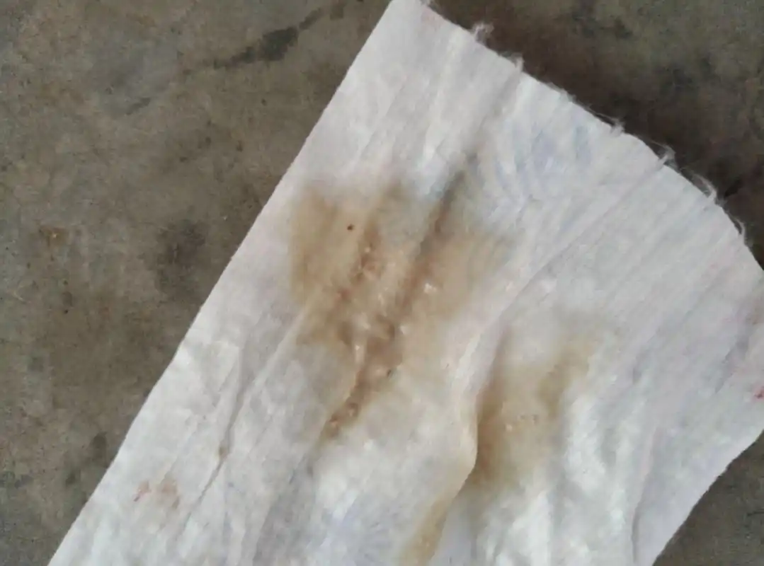 孕晚期 这种分泌物咋回事 这图片不知道能不能发