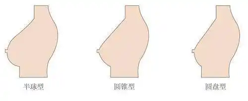 怎么判断自己的胸型是不是圆盘胸大圆盘呢