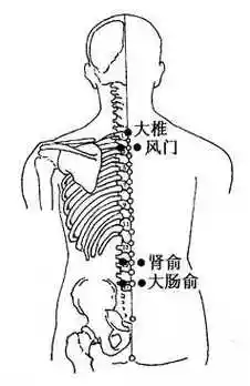 慢性腰痛的拔罐疗法