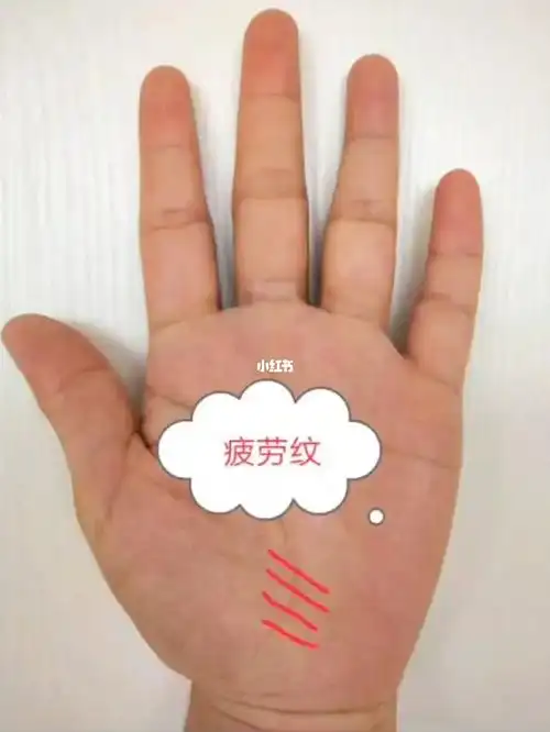 生命线尾端出现这种小细斜纹的时候,证明你的身体已经很疲惫了,要注意