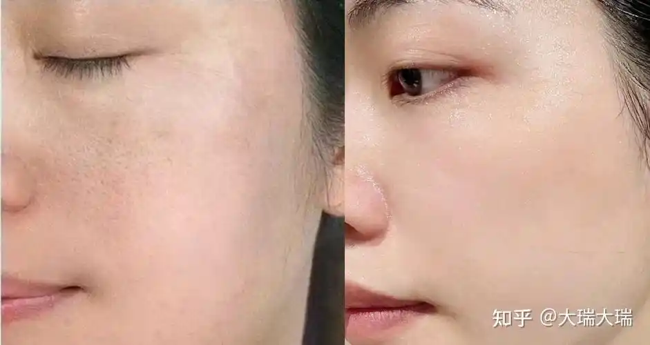 李佳琦推荐过什么抗衰老护肤品?双重a醇抗皱敷料真的猛吗? - 知乎