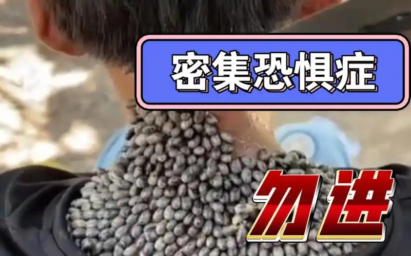 密集恐惧症的勿进