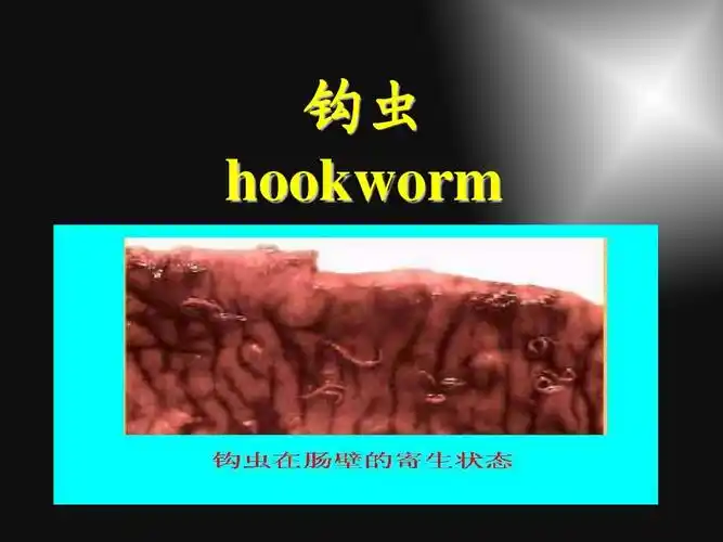 寄生虫学习资料 钩虫 hookworm