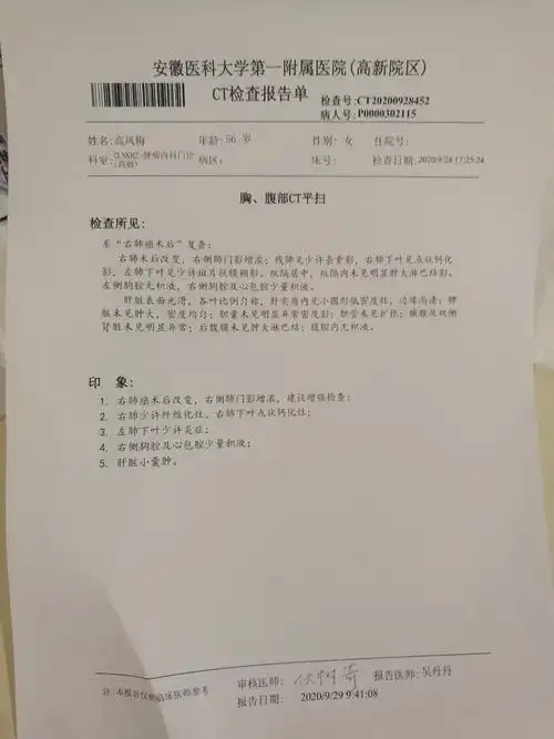 最新的ct报告
