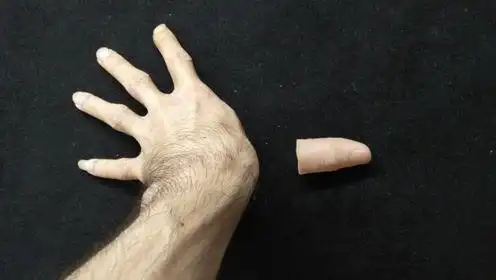 小伙子把自己手指拔继还原,骗了10人一分钟学会小魔术