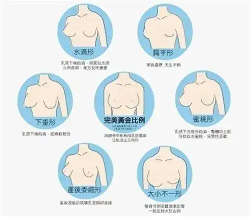 20几岁隆胸是种什么体验?真人体验:胸都跑下边去了!