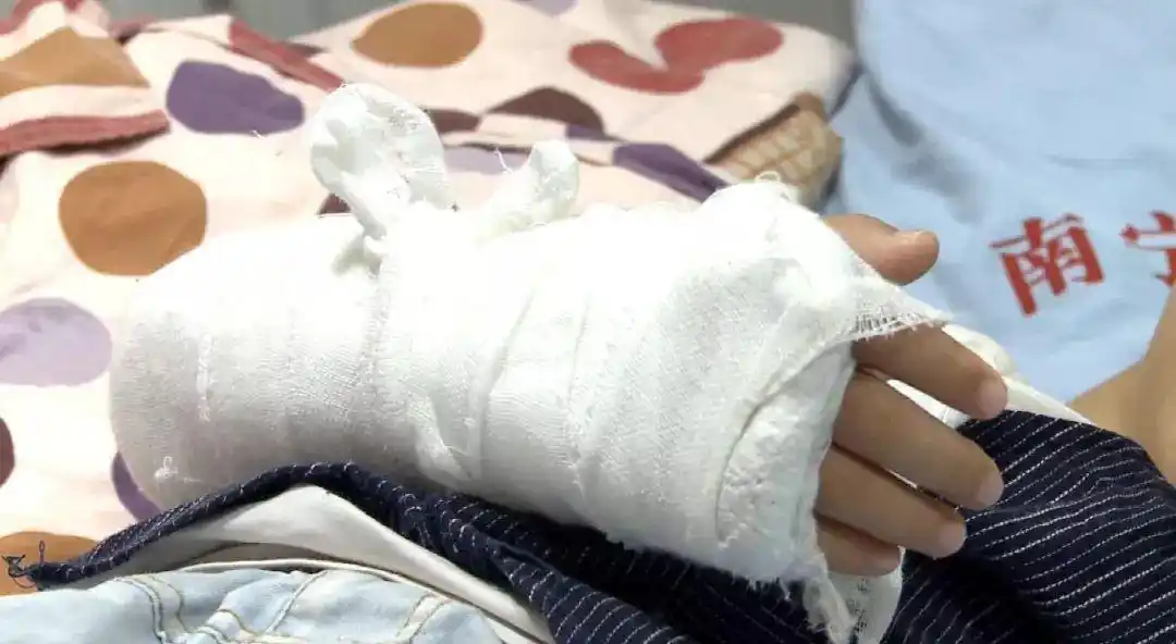 6岁男孩在游乐场手臂骨折,这个项目孩子们都爱玩!