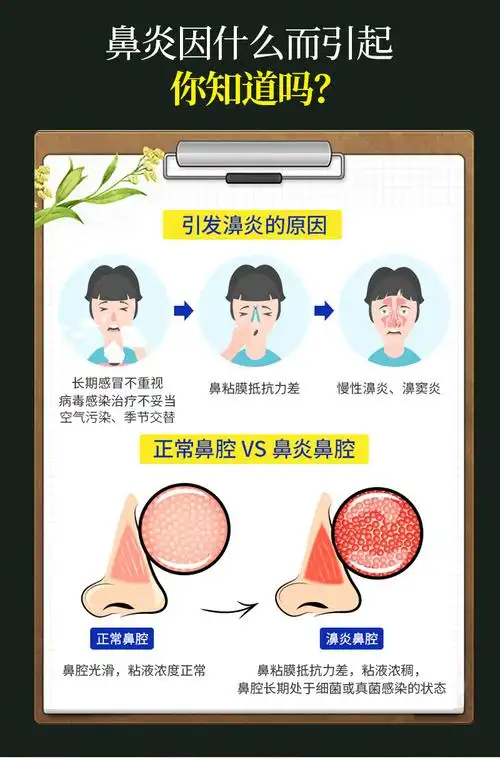 适用于鼻炎贴儿童大人过敏性鼻窦炎排脓神器鼻息肉鼻甲肥大专用中药贴