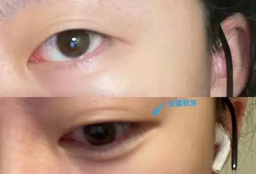 眼尾有一条沟画眼线就会夹在那个沟里面求助同眼型姐妹怎么画眼线