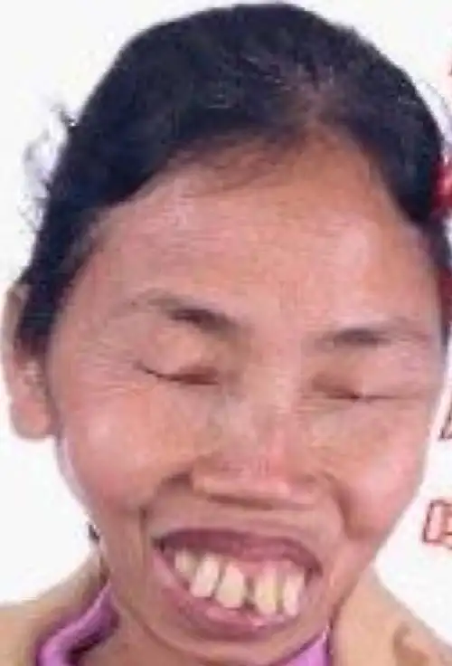 《美丑绝对论》第二期:盘点全球50位极丑女人,让你一次看个够!