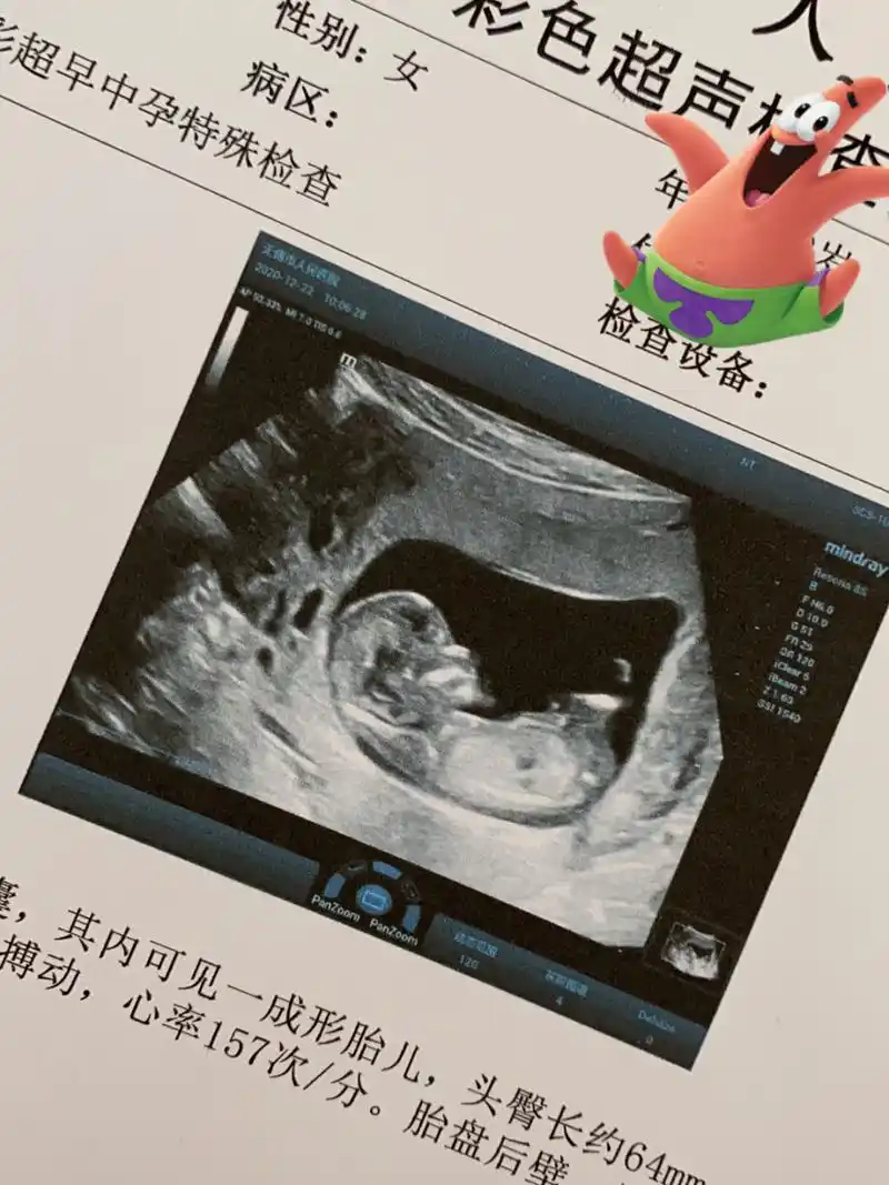 nt秒过啦,来猜猜男宝女宝呢?