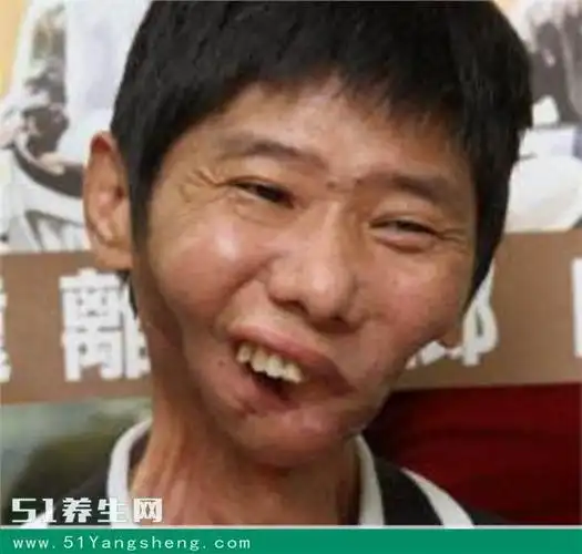 首页 养生资讯 喜欢吃槟榔的不是少数,在央视报道中提到,"据统计,目前