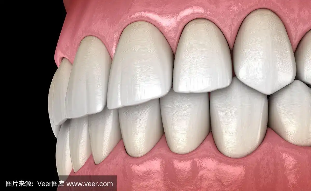 侧面图,正常咬合的健康人类牙齿.医学上准确的牙齿3d插图