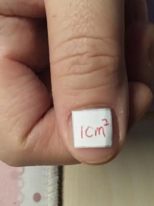 大母指甲盖 大约1平方厘米