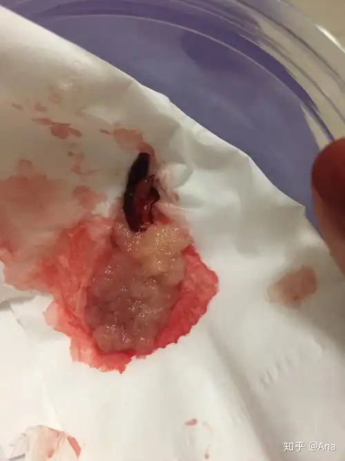 记录下我的药流过程