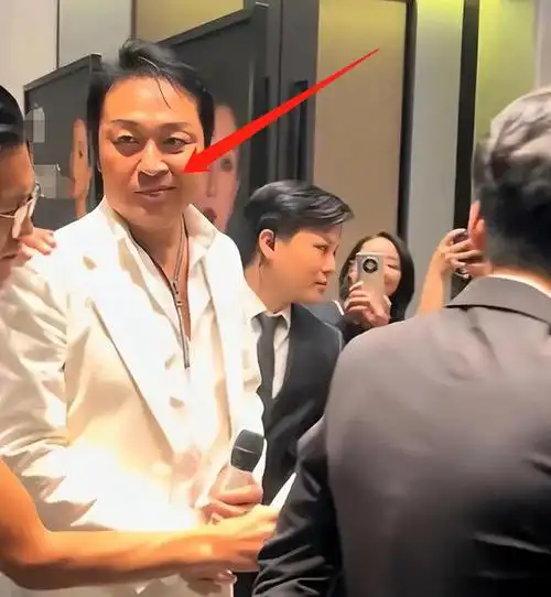 61岁马景涛被疑中风左脸歪斜右脸肿和小25岁娇妻结婚压力大