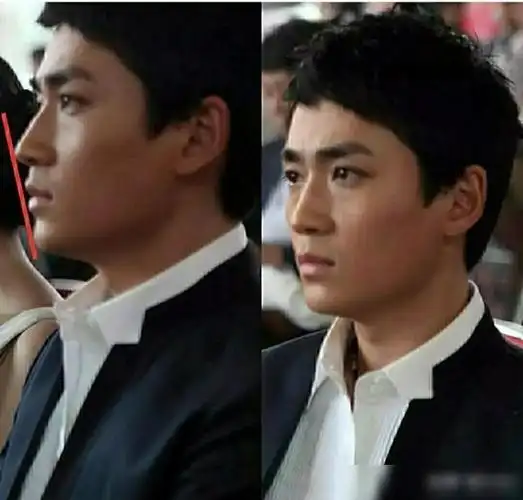 长文多图仔细分析朱一龙究竟也没有整容