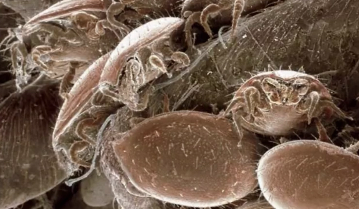 床上几天不清洁螨虫成窝,用这招怎么睡都不会生螨虫