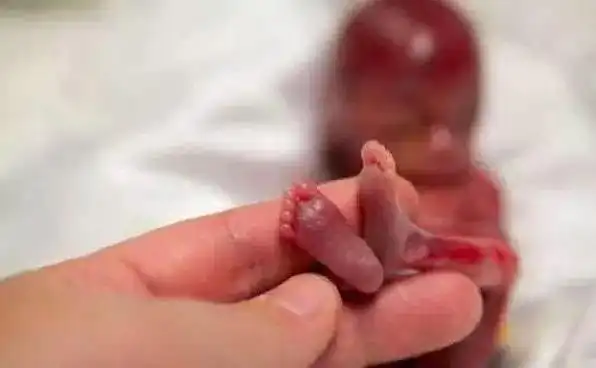 19周大的婴儿奇迹般存活数周令人动容看过之后忍不住泪崩