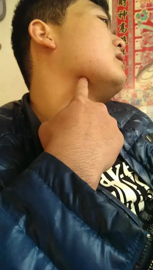 你好我右腮下边靠近扁挑体那地方有个疙瘩,跟花生米差不多大