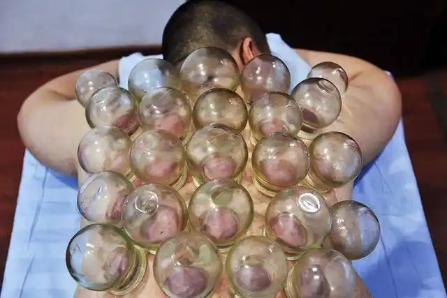 如果平时经常拔罐,不妨自己对比一下.