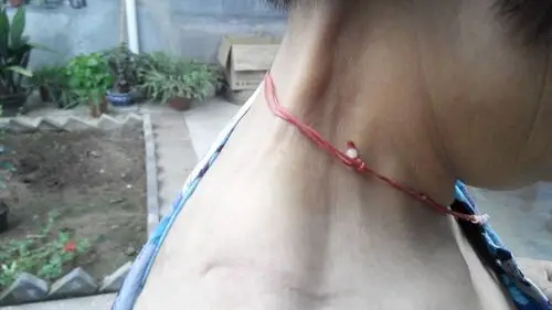 家里老人这两天脖颈部位凸起一根筋,差不多有一周左右,开始没有明显