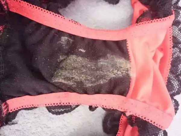 为什么每天早上醒来内裤上都会有这么多脏东西?是妇科病吗?