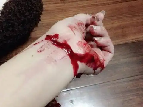 梦见手腕割破流血